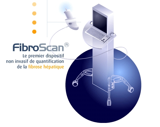 fibroscan.jpg fibroscan.jpg